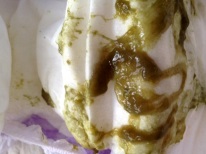 Diarreia com muco em lactentes