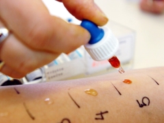 Testes cutâneos para alérgenos em crianças