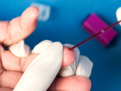 Exame de sangue geral da criança