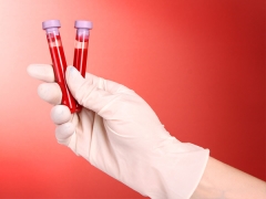 Серологичен кръвен тест за хепатит, HIV, сифилис и други заболявания