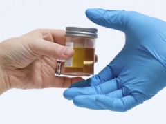 Urinanalyse bei Kindern