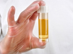 Proteína na urina de uma criança