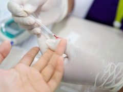 Contagem de plaquetas elevada no sangue de uma criança