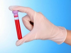 WBC اختبار الدم في الأطفال