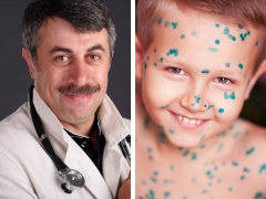 Dr Komarovsky: kung ano ang chickenpox at kung paano ituring ito
