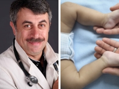 Dr Komarovsky mengenai displasia pinggul pada kanak-kanak
