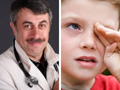 Si Dr. Komarovsky sa conjunctivitis