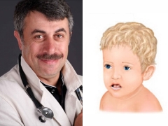 Dr Komarovsky sa paggamot ng thrush sa bibig sa mga bata