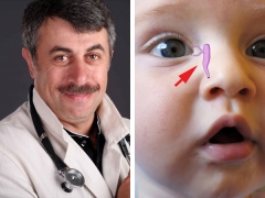 Dr. Komarovsky sobre a massagem do canal lacrimal em recém-nascidos