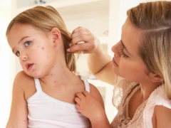Exantema infeccioso em crianças