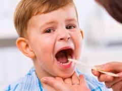 Wie sieht der Hals eines Kindes mit Pharyngitis aus?