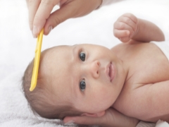 Seborrhoische Dermatitis bei Säuglingen und Neugeborenen