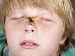Wie entfernen Sie Schwellungen und Juckreiz bei einem Kind nach einem Insektenstich?