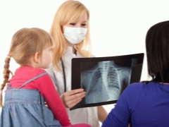 Sintomas e tratamento da tuberculose em crianças