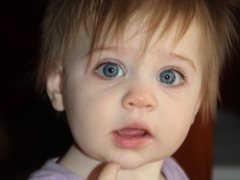 Anisocoria - different pupils in size in a child