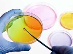 Como passar e decifrar a cultura de urina bacteriológica durante a gravidez?