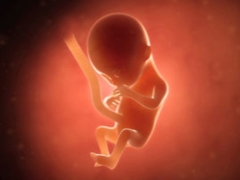 Why do we need screening in the first trimester, when it is conducted and what it shows?