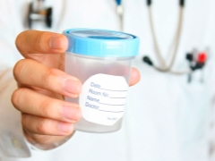 Vorbereitung für das Spermogramm und Regeln für die Durchführung der Analyse