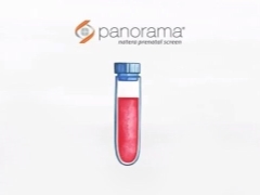 Warum testen sie Panorama während der Schwangerschaft und wie lauten die Bewertungen dazu?