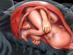 Types of umbilical cord attachment to the placenta: norms and risk of deviations