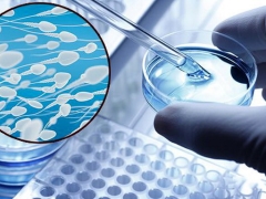 Was sollte ein Spermogramm für IVF sein und wie kann man die Leistung verbessern?
