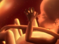 Emaranhamento fetal do cordão umbilical: causas e consequências