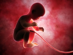 Types of umbilical cord attachments and effects on the fetus