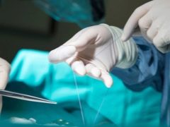 Eigenschaften der Nahtheilung nach einer Episiotomie und Lösung möglicher Probleme