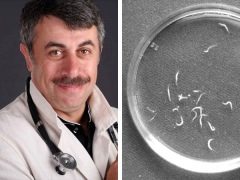 Dr. Komarovsky mengenai pinworms dan parasit lain