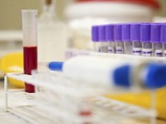 Çocuklarda İmmünglobulin E: normlar ve sapmaların nedenleri