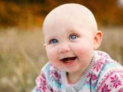 Alopecia pada kanak-kanak: penyebab dan kaedah rawatan