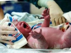 Asphyxia yang baru lahir: dari sebab untuk berlaku