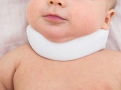 علامات وأعراض صعر في الأطفال حديثي الولادة والرضع