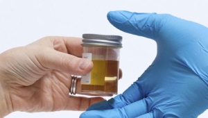 Urinanalyse bei Kindern