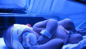 Fototerapi untuk bayi baru lahir dengan penyakit kuning