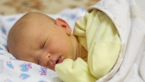 Konjugat jaundis bayi baru lahir