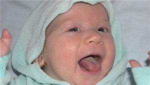 Stomatitis bei Kindern am Zahnfleisch