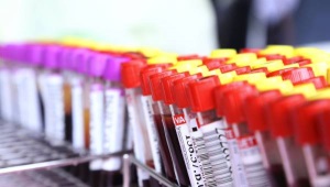 Blood platelet norm in children