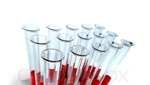Ang isang bata ay may mataas na monocytes sa dugo.