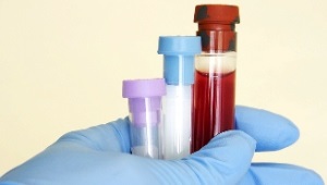 Reduced neutrophils in the blood of a child