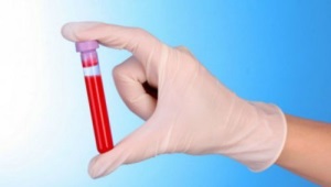 WBC blood test in children