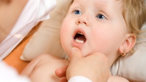 Trus sa isang bata pagkatapos kumukuha ng antibiotics
