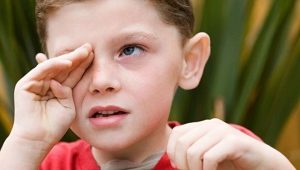 Bacterial conjunctivitis sa mga bata