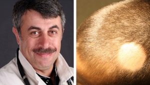 Dr Komarovsky tungkol sa mga sanhi ng pagkawala ng buhok sa mga bata