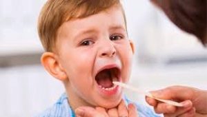 Ano ang hitsura ng lalamunan ng isang bata na may pharyngitis?