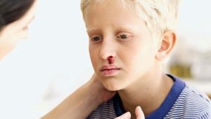 Thrombocytopenic purpura sa mga bata