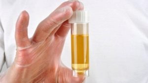 Protein im Urin während der Schwangerschaft: Normen und Ursachen für Abweichungen