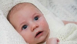 Como distinguir entre perda de calor e alergias em bebês?