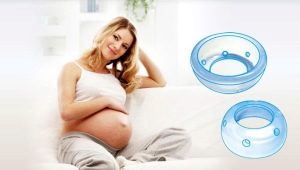 Obstetrik pessary Doctor Arabin