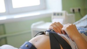 How can CTG detect contractions?